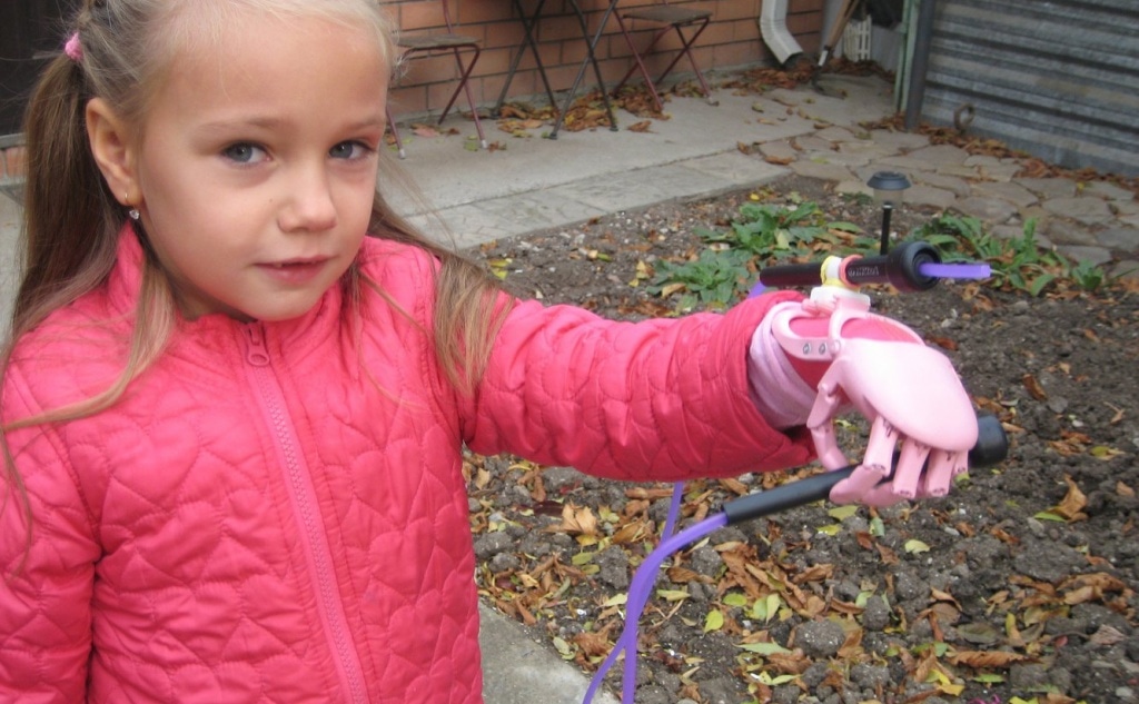 В Рунете собирают деньги на детский протез, как у Дарта Вейдера